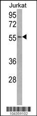 Anti-USP22 Rabbit Polyclonal Antibody