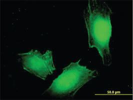 Anti-MAGEA4 Mouse Monoclonal Antibody [clone: 3D12]