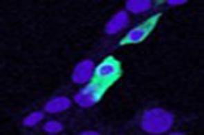 Anti-CLIC4 Antibody (A84333) (5 µg/ml) staining of min6 cells transiently expressing mouse Clic4 Nuclear counter staining by Hoechst