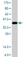 Anti-AKR1C1 Mouse Polyclonal Antibody