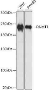 Western blot analysis of extracts of various cell lines, using Anti-Dnmt1 Antibody (A307715) at 1:1000 dilution. The secondary Antibody was Goat Anti-Rabbit IgG H&L Antibody (HRP) at 1:10000 dilution. Lysates/proteins were present at 25 µg per lane