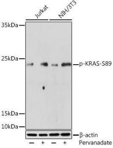 Western blot analysis of extracts of various cell lines, using Anti-KRAS (phospho Ser89) Antibody (A308919) at 1:500 dilution Jurkat cells were treated by Pervanadate (1 mM) at 37°C for 30 minutes NIH/3T3 cells were treated by Pervanadate (1 mM) at 37°C for 30 minutes