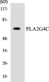 Western blot analysis of the lysates from HeLa cells using Anti-PLA2G4C Antibody