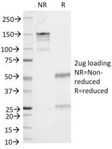 SDS-PAGE analysis of Anti-CD53 Antibody [161-2] under non-reduced and reduced conditions; showing intact IgG and intact heavy and light chains, respectively. SDS-PAGE analysis confirms the integrity and purity of the Antibody