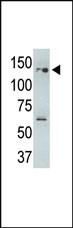 Anti-USP25 Rabbit Polyclonal Antibody