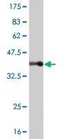 Anti-IRX3 Mouse Monoclonal Antibody [clone: 3D8]