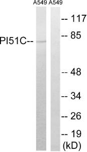 Anti-PIP5K1C antibody