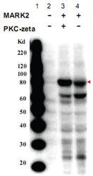 Anti-MARK2 Rabbit Polyclonal Antibody