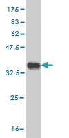 Anti-NUP133 Mouse Monoclonal Antibody [clone: 3E8]