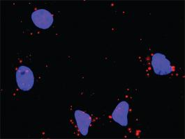 Anti-NFKB1 + HDAC1 Antibody Pair