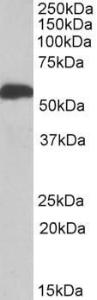 Antibody anti-ALDH5A1 A82751-100 100 µg