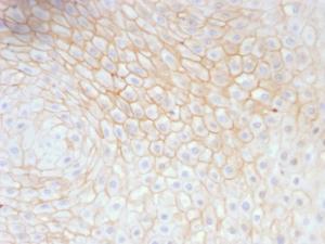 Anti-CD59 Mouse Monoclonal Antibody [Clone: MACIF/629]