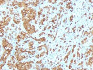 Anti-MelanA antibody