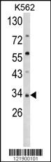 Anti-SFRP5 Rabbit Polyclonal Antibody