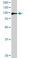 Anti-AR Goat Polyclonal Antibody