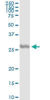 Anti-IL27 Antibody Pair