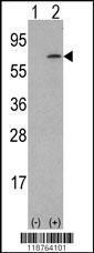 Anti-Macrophage Colony Stimulating Factor Rabbit Polyclonal Antibody