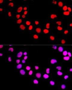 Immunofluorescence analysis of 293T cells using Anti-Dnmt1 Antibody (A307715) at a dilution of 1:100 (40X lens). DAPI was used to stain the cell nuclei (blue)