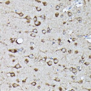 Immunohistochemistry analysis of paraffin-embedded rat brain using Anti-KRAS (phospho Ser89) Antibody (A308919) at a dilution of 1:100 (40x lens) Perform high pressure antigen retrieval with 10 mM citrate buffer pH 60 before commencing with IHC staining protocol