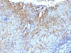 Immunohistochemical analysis of formalin-fixed, paraffin-embedded human tongue using Anti-CD59 Antibody [SPM616]