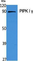 Anti-PIP5K1C antibody