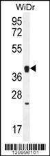 Anti-OR2T8 Rabbit Polyclonal Antibody (FITC (Fluorescein Isothiocyanate))