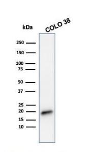 Anti-MelanA antibody