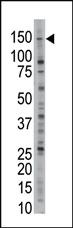 Anti-USP28 Rabbit Polyclonal Antibody