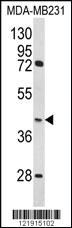 Anti-RHBDF2 Rabbit Polyclonal Antibody