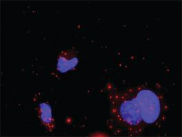 Anti-MAPKAPK5 + MAPK1 Antibody Pair