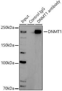 Immunoprecipitation analysis of 300 µg extracts of Jurkat cells using 3 µg of Anti-Dnmt1 Antibody (A307715). This Western blot was performed on the immunoprecipitate using Anti-Dnmt1 Antibody (A307715) at a dilution of 1:1000