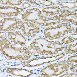 Immunohistochemistry analysis of paraffin-embedded mouse kidney using Anti-KRAS (phospho Ser89) Antibody (A308919) at a dilution of 1:100 (40x lens) Perform high pressure antigen retrieval with 10 mM citrate buffer pH 60 before commencing with IHC staining protocol