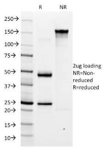 Anti-Helicobacter pylori antibody