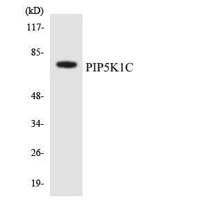 Anti-PIP5K1C antibody