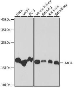 Western blot analysis of extracts of various cell lines, using Anti-LMO4 Antibody [ARC2114] (A308920) at 1:1000 dilution. The secondary Antibody was Goat Anti-Rabbit IgG H&L Antibody (HRP) at 1:10000 dilution. Lysates/proteins were present at 25 µg per lane