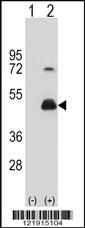 Anti-RHBDF2 Rabbit Polyclonal Antibody