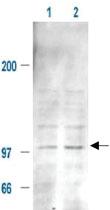 Anti-MDM2 Rabbit Polyclonal Antibody