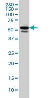 Anti-TBL1XR1 Mouse Monoclonal Antibody [clone: 3G7]