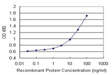 Anti-NEK10 Antibody Pair