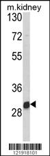 Anti-NAT2 Rabbit Polyclonal Antibody