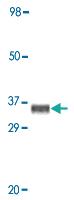 Anti-MAPK10 Mouse Monoclonal Antibody [clone: 8A5D11]