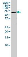 Anti-EDC3 Mouse Monoclonal Antibody [clone: 4E3-3A4]