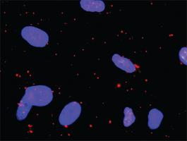 Anti-PXN + MAPK1 Antibody Pair