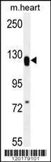 Anti-MED14 Rabbit Polyclonal Antibody (Biotin)