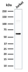 Western blot analysis of Jurkat cell lysate using Anti-CD63 Antibody [LAMP3/2881]