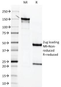 Antibody anti-TNFAIP3 TNFAIP32813 100 µg