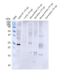 Western blot analysis of Human, mouse, rat A549, T-47D cells, mouse and rat brain, kidney showing detection of RAB3D protein using Anti-Rab3D Antibody [5E9] (A304812) at 1:1000 for 2 hours at room temperature with shaking. Lane 1: MW ladder. Lane 2: WT A549 cells