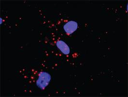 Anti-STAT5A + MAPK1 Antibody Pair