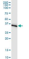 Anti-AKR1C1 Polyclonal Antibody Pair