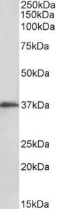 Anti-MSI2 Antibody (A82754) (01 µg/ml) staining of Kelly lysate (35 µg protein in RIPA buffer) Detected by chemiluminescence